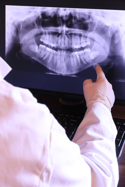 Best Emergency Root Canal Treatment in Woodsville, NH