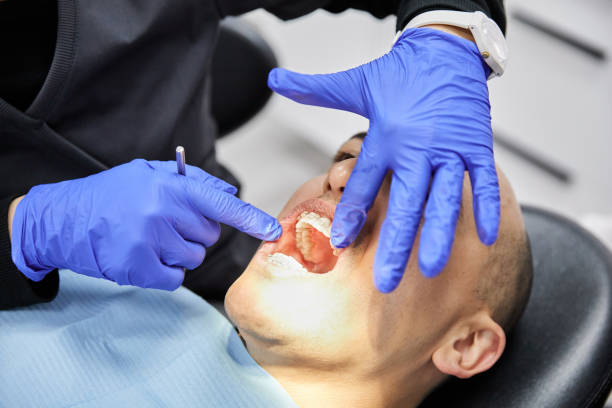 Best Emergency Dental Care for Broken or Chipped Teeth in Woodsville, NH